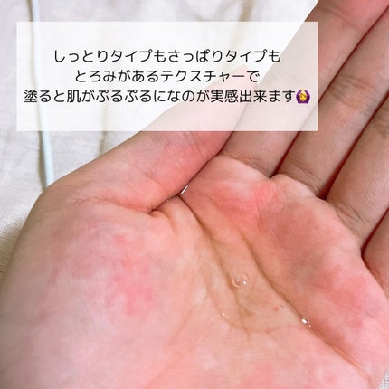 ダーマレーザー スーパーVC100ローション(さっぱり)/クオリティファースト/化粧水を使ったクチコミ(3枚目)