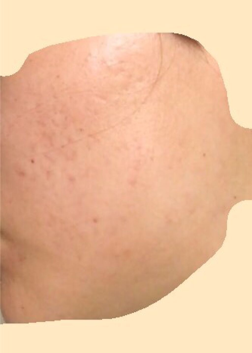 敏感肌用薬用美白美容液/無印良品/美容液を使ったクチコミ(4枚目)