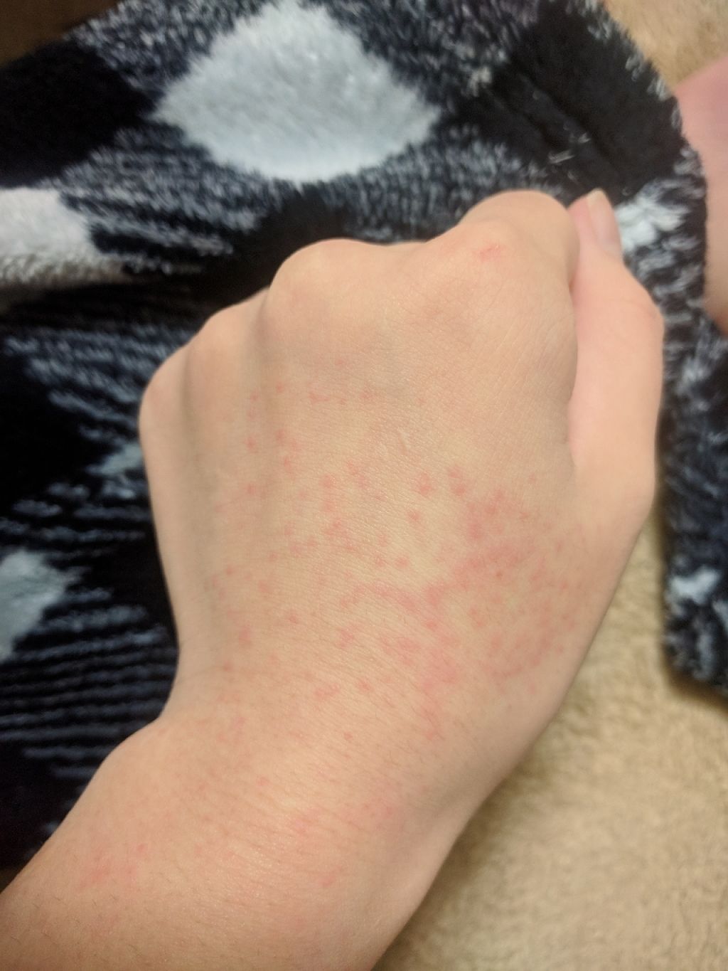 ジョンソン ベビーオイル 無香料/ジョンソンベビー/ボディオイルを使ったクチコミ（3枚目）