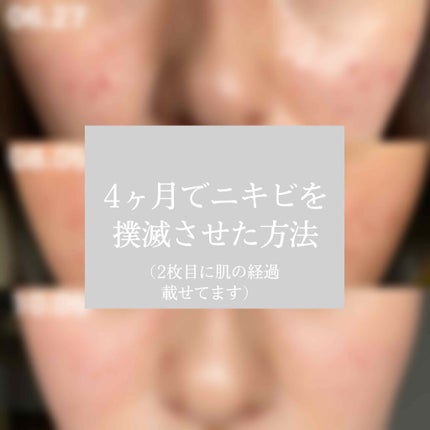 ディープモイスチャースプレー/キュレル/ミスト状化粧水を使ったクチコミ(1枚目)