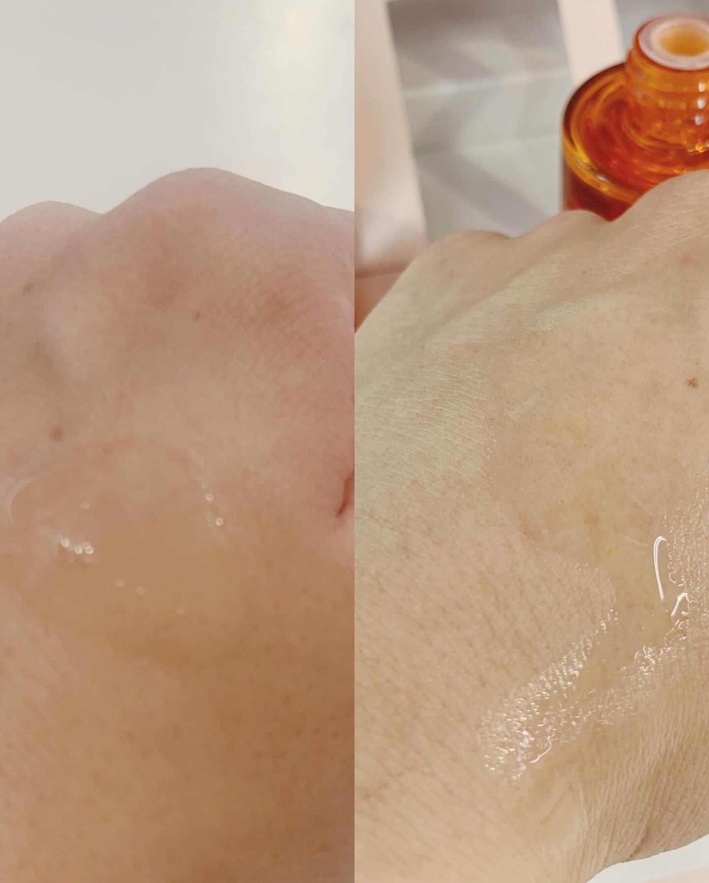 レッドタンジェリンVITA-Cカプセルセラム/DERMASHARE/美容液を使ったクチコミ（3枚目）