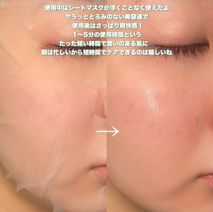 レッドブレミッシュクイックPHAシートマスク/Dr.G/シートマスク・パックを使ったクチコミ(5枚目)