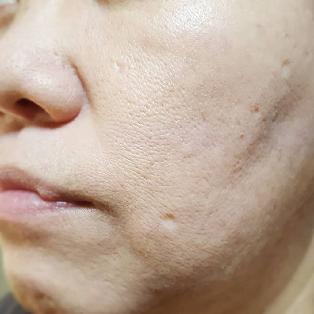 M クッションファンデーション(ネオカバー)/MISSHA/クッションファンデーションを使ったクチコミ(4枚目)