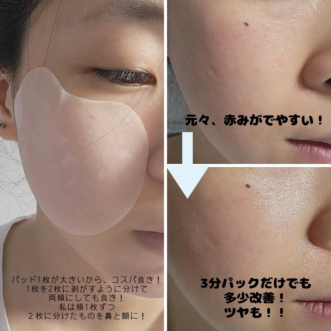 ドクダミテンダーゾームダブルカーミング水分アンプル/ilso/美容液を使ったクチコミ(4枚目)