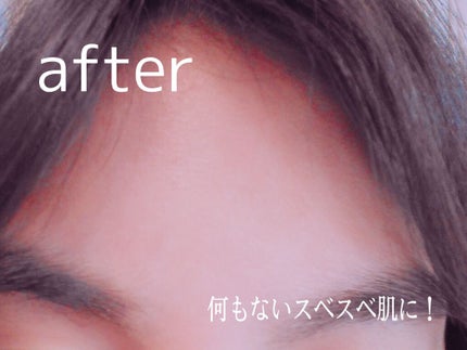 明色美顔水 薬用化粧水/美顔/化粧水を使ったクチコミ(3枚目)