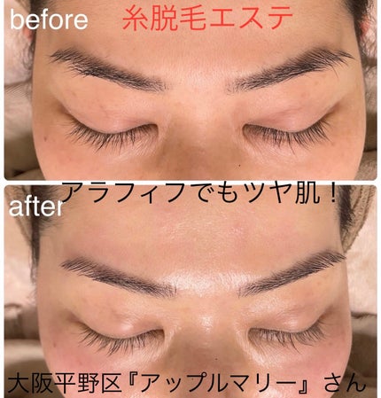 を使ったクチコミ(1枚目)