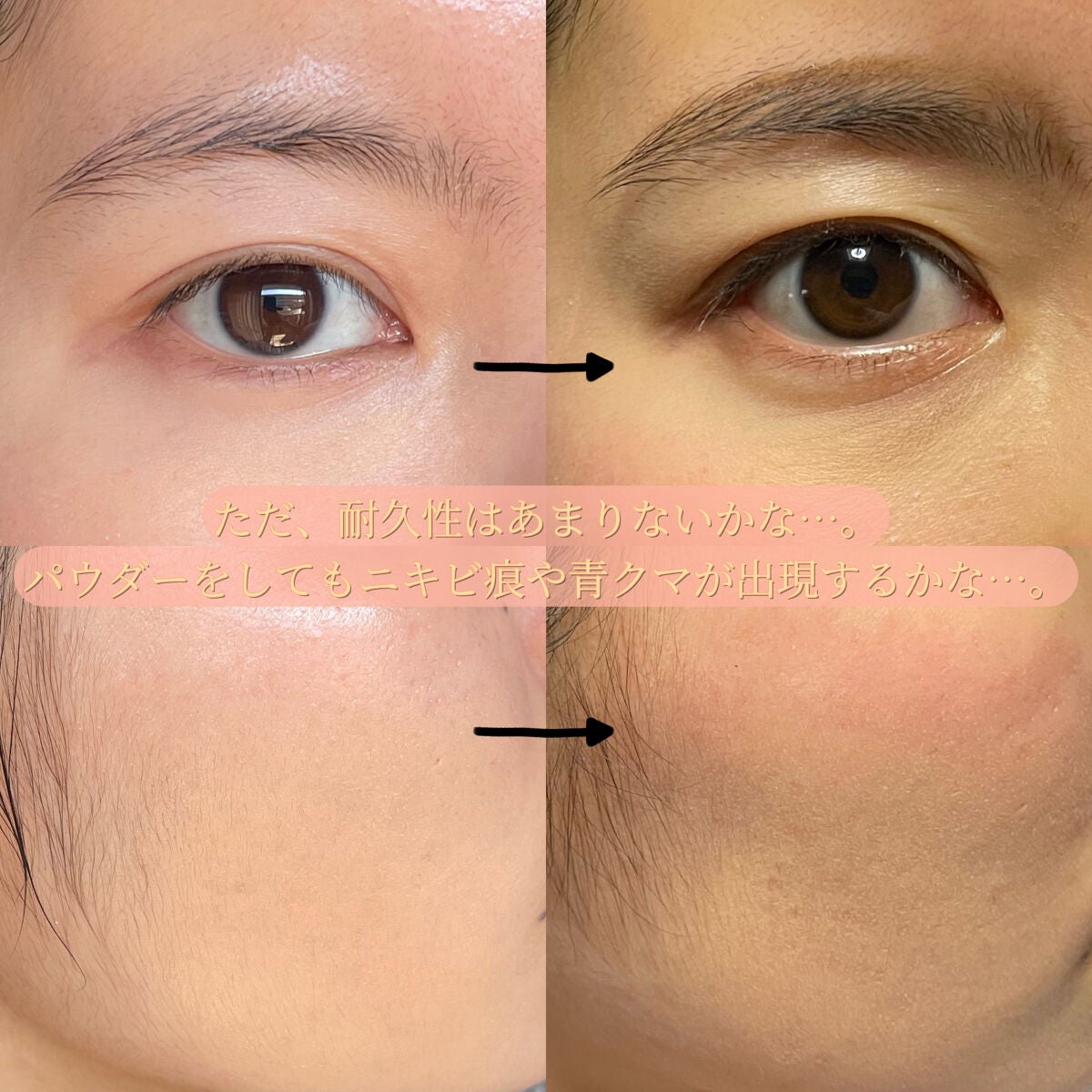 &be ファンシーラー/&be/パレットコンシーラーを使ったクチコミ(5枚目)