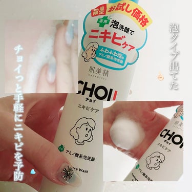 【数量限定価格】 ふわ泡でチョイっと手軽にニキビ予防👆🏻


肌美精 CHOI 

薬用泡洗顔 ニキビケア 

👛 399円

.

肌美精CHOIシリーズ　ニキビケアライン 

くり返しがちなニキビ・