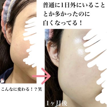 メラノCC 薬用しみ対策 美白化粧水 しっとりタイプのクチコミ「

【美白を目指す全女子におすすめ！！】

本当にプチプラ！？
って思うほど効果のあった化粧水.....」（2枚目）