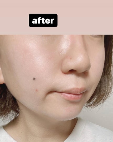 ACジェルクレンジング/NIKI PITA/クレンジングジェルを使ったクチコミ(8枚目)