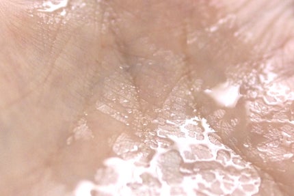 エファクラ ピールケア セラム/ラ ロッシュ ポゼ/美容液を使ったクチコミ(5枚目)