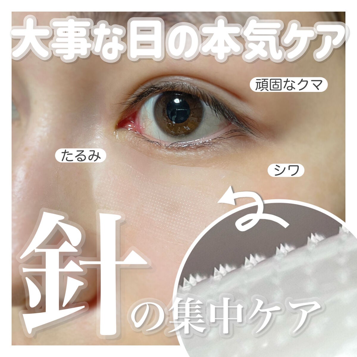 W+ マイクロ ニードル パッチ/SNP/アイケア・アイクリームを使ったクチコミ(1枚目)