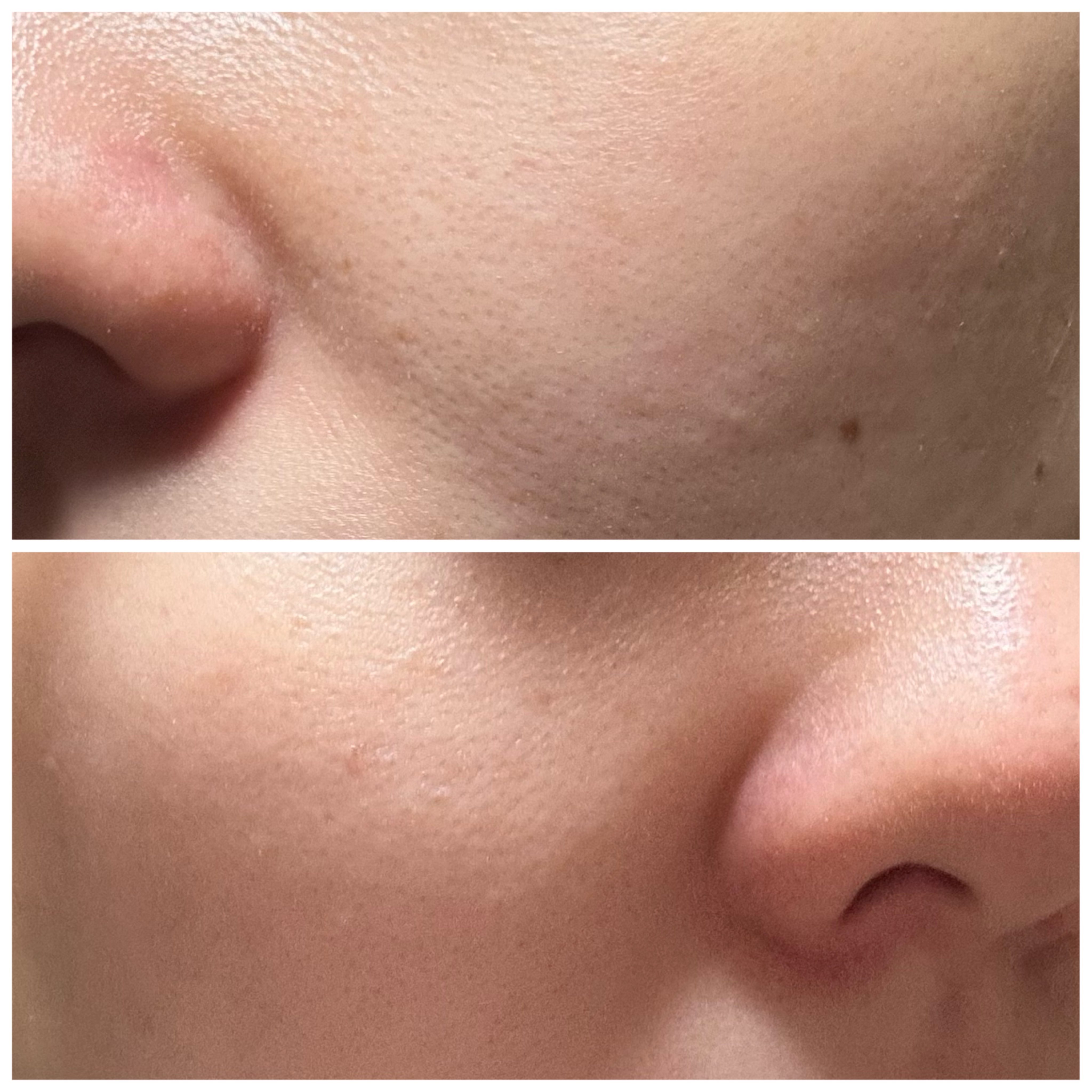 ドクダミ 77 スージングトナー/Anua/化粧水を使ったクチコミ（3枚目）