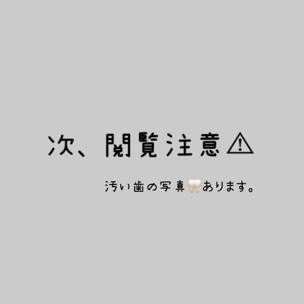 重曹つるつるハミガキ/毛穴撫子/歯磨き粉を使ったクチコミ(1枚目)