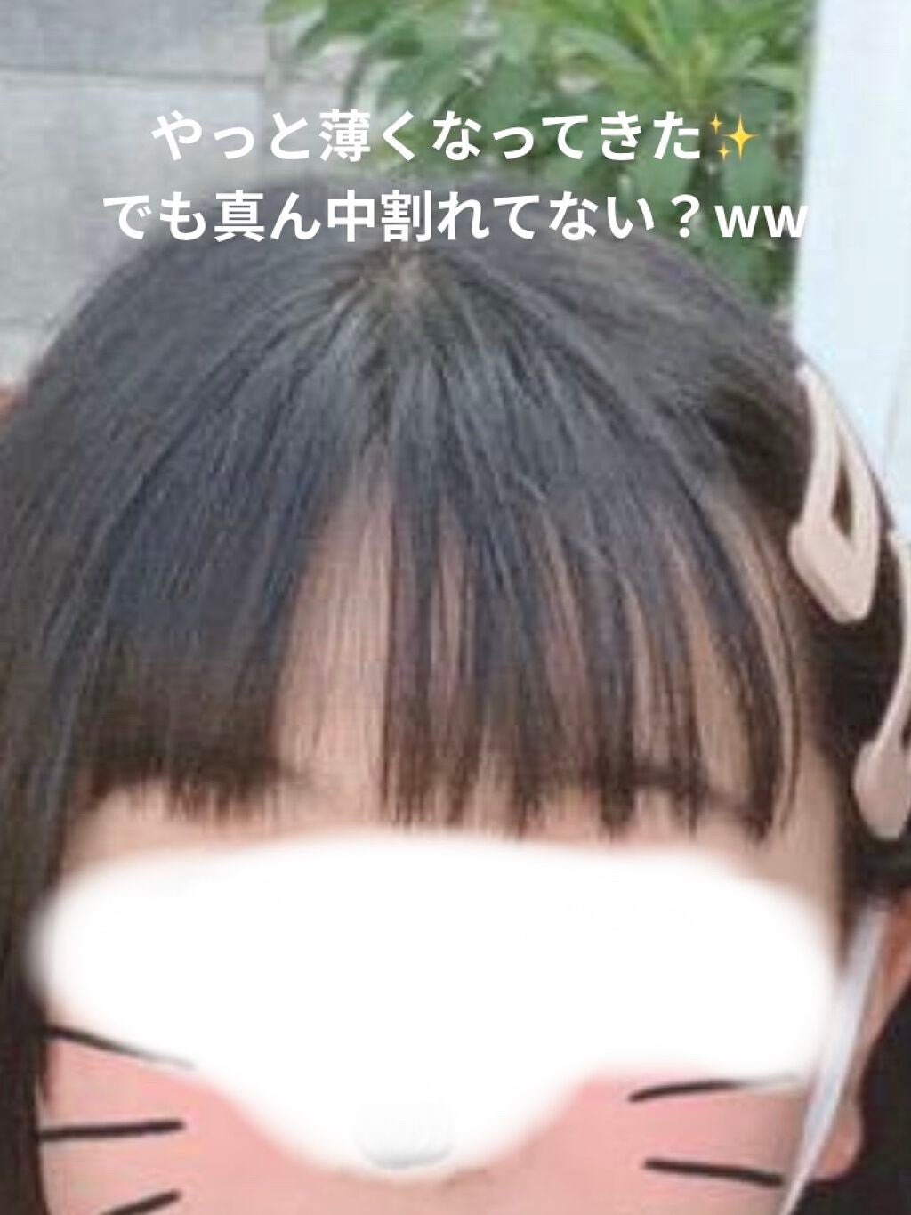 アコアコ♡ on LIPS 「アコアコ♡です!今回は私の前髪垢抜け日記を紹介したいと思います..」(4枚目)