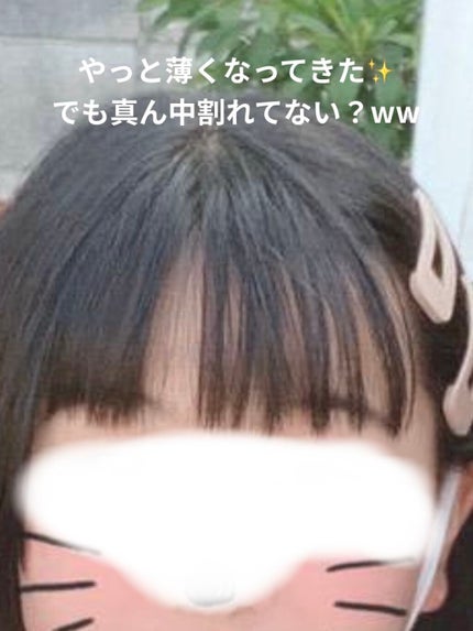 アコアコ♡ on LIPS 「アコアコ♡です!今回は私の前髪垢抜け日記を紹介したいと思います..」(4枚目)