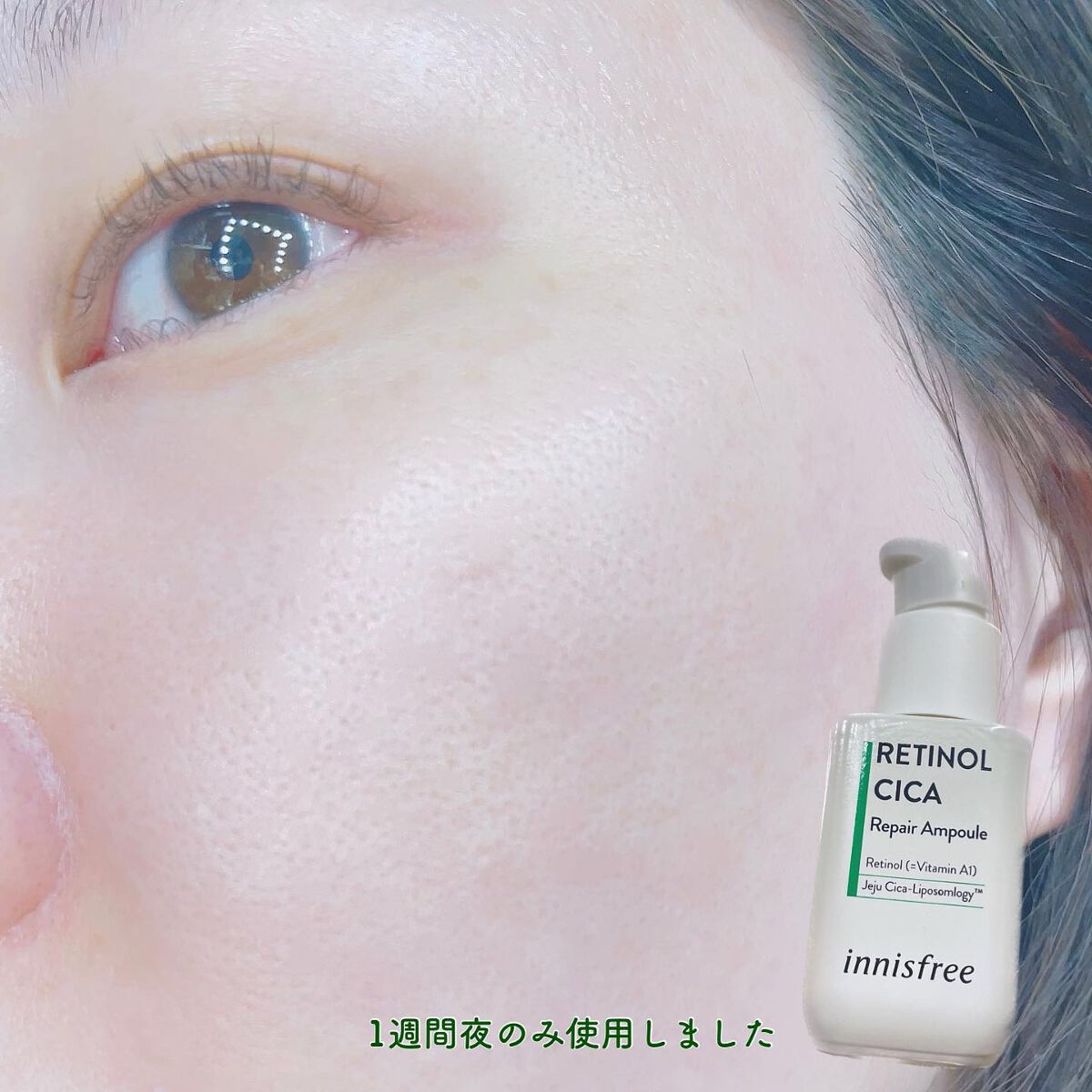 レチノール　シカ　リペア　セラム/innisfree/美容液を使ったクチコミ（2枚目）