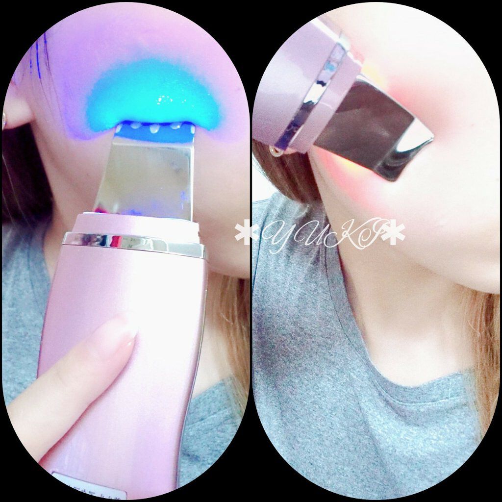 美ルル アクアルファ/belulu/美顔器・マッサージを使ったクチコミ(3枚目)