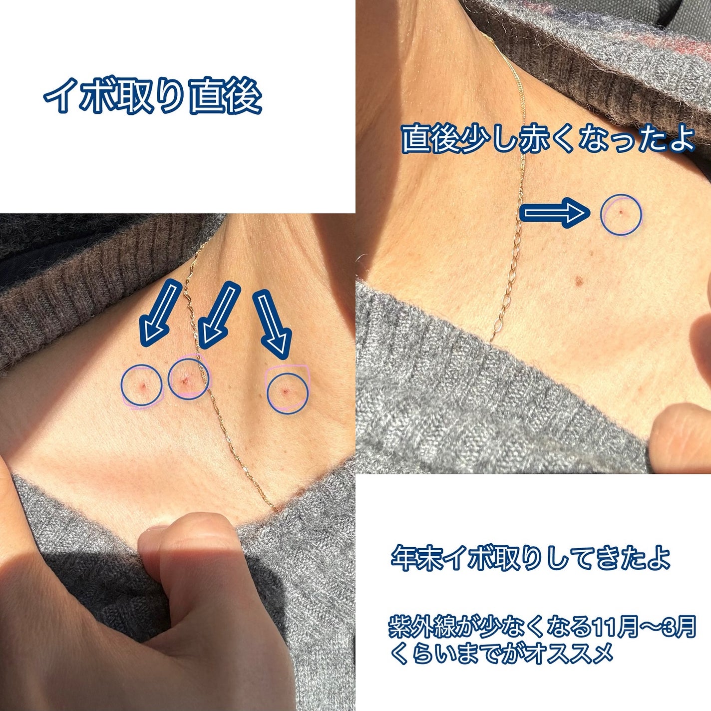 グラスティングカラーグロス/rom&nd/リップグロスを使ったクチコミ(3枚目)