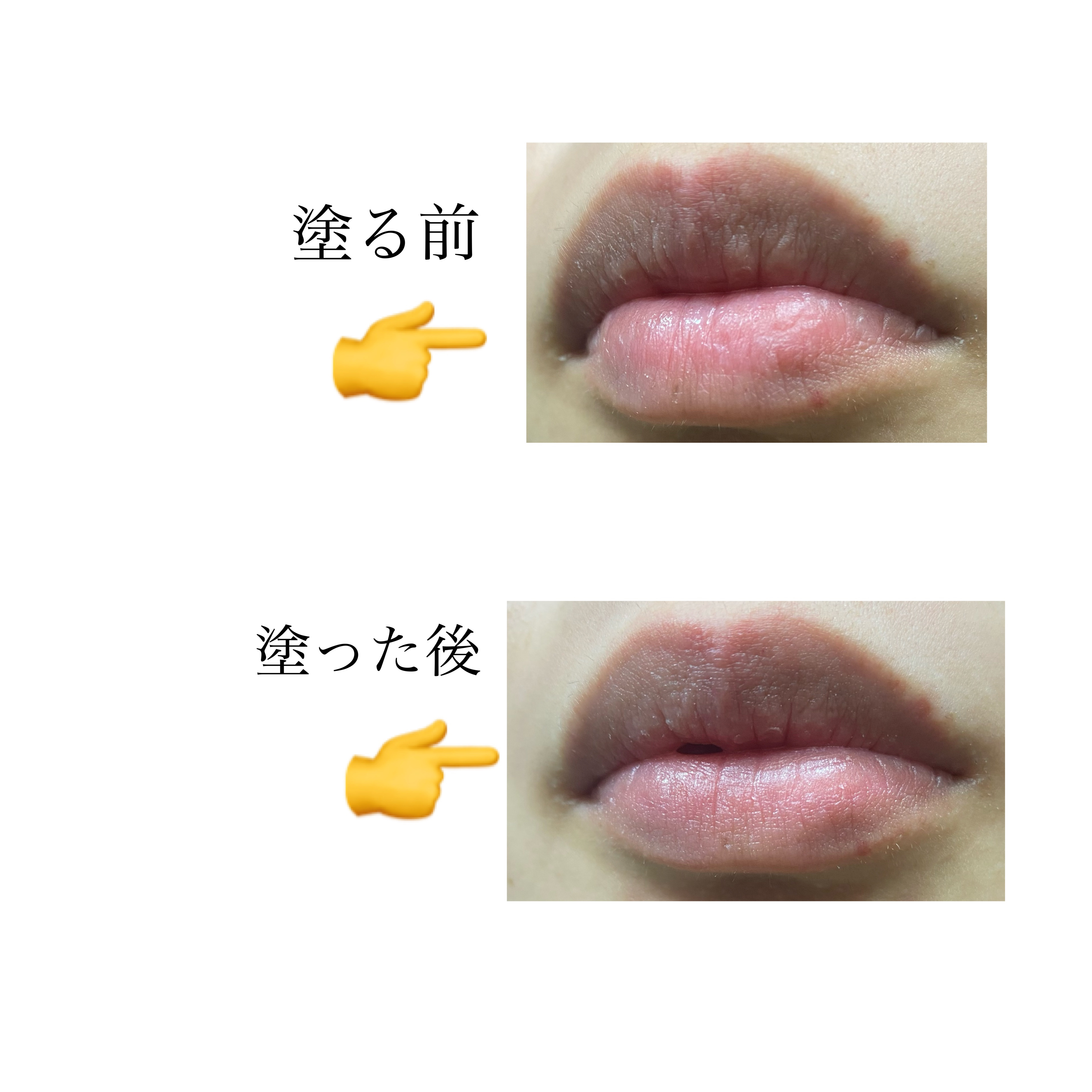 モイスチャーリップ ビタミンE/ニベア/リップクリームを使ったクチコミ（3枚目）