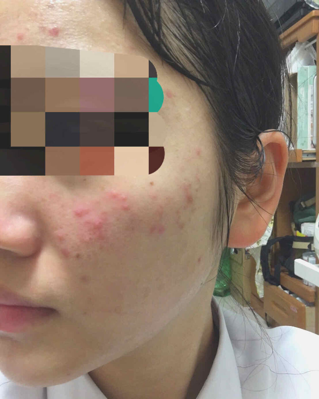 ハトムギ化粧水(ナチュリエ スキンコンディショナー R )/ナチュリエ/化粧水を使ったクチコミ（2枚目）