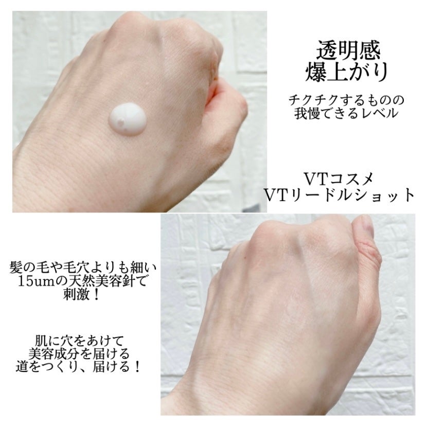 リードルショット300/VT/美容液を使ったクチコミ(4枚目)