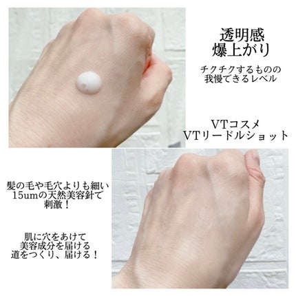 リードルショット300/VT/美容液を使ったクチコミ(4枚目)