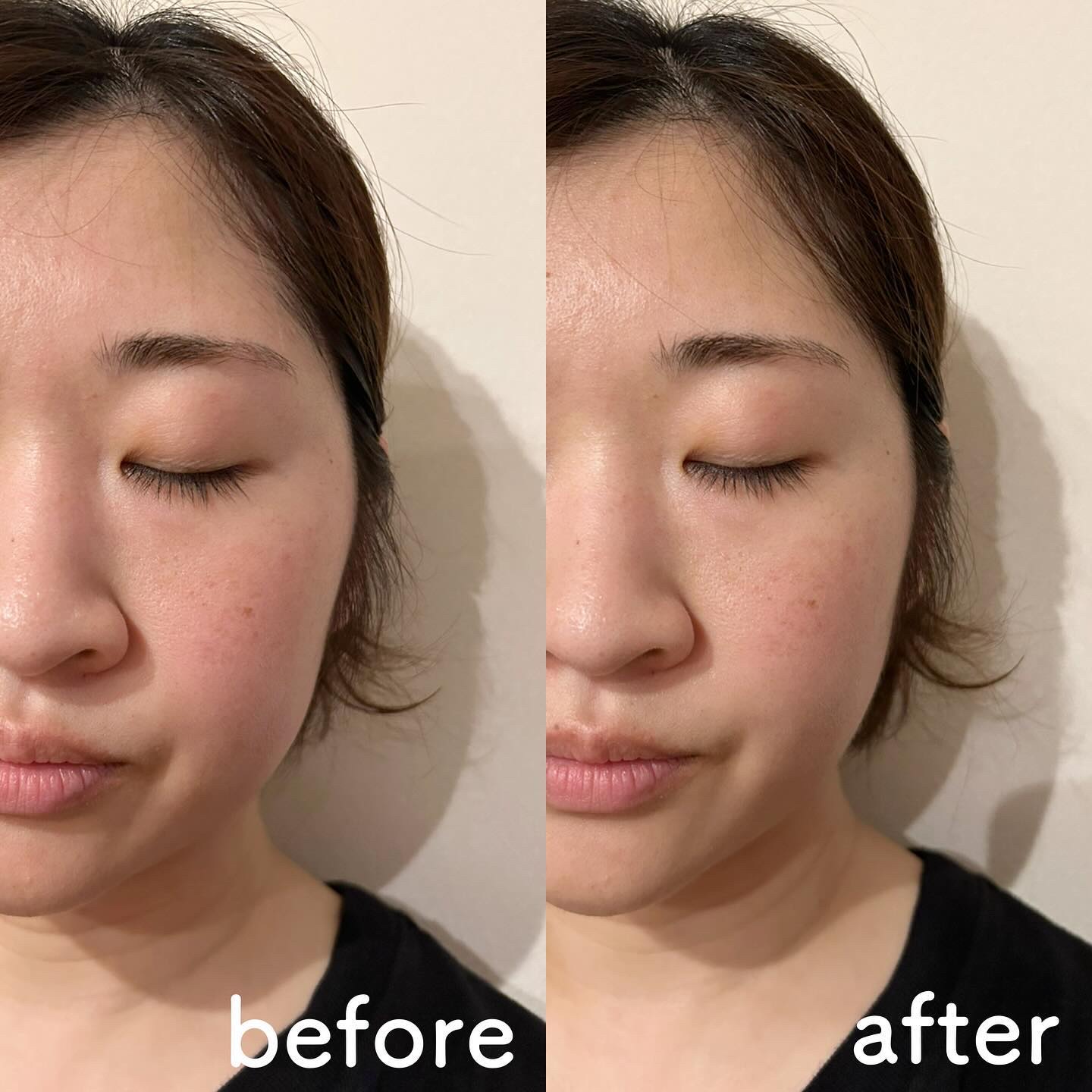 スカルプ電気ブラシ/アンファー(スカルプD)/美顔器・マッサージを使ったクチコミ（3枚目）