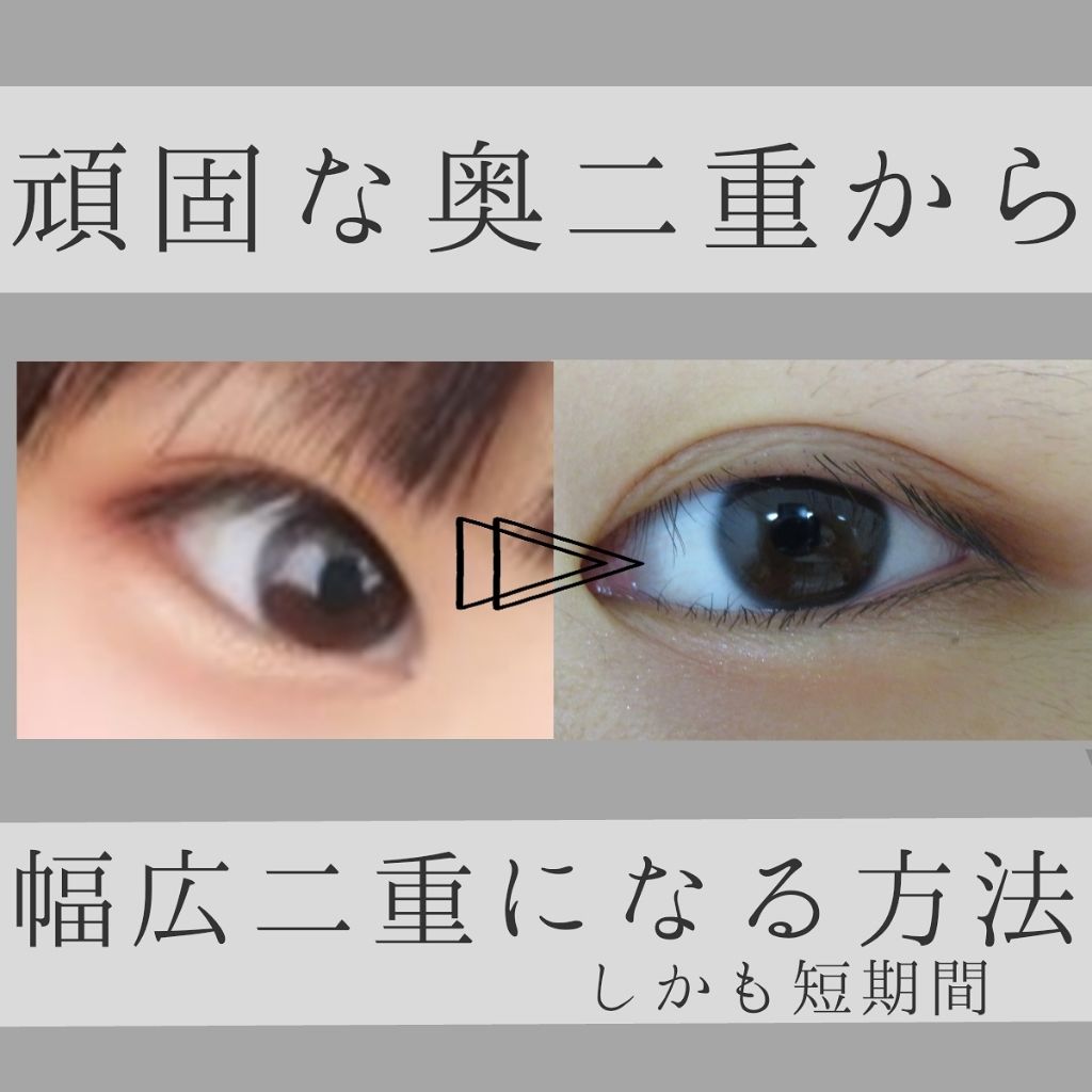 市場 ポイント2倍 二重 まぶた 癖付け 化粧品 メイク 二重まぶた 二重瞼 アイプチ 二重まぶた化粧品 くっきり二重 二重まぶた形成 ふたえ クセ付け