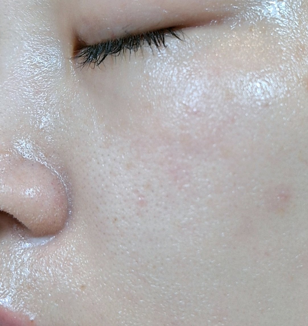 プエラフィカクレンジング/ドクターベルツ/クレンジングクリームを使ったクチコミ（3枚目）