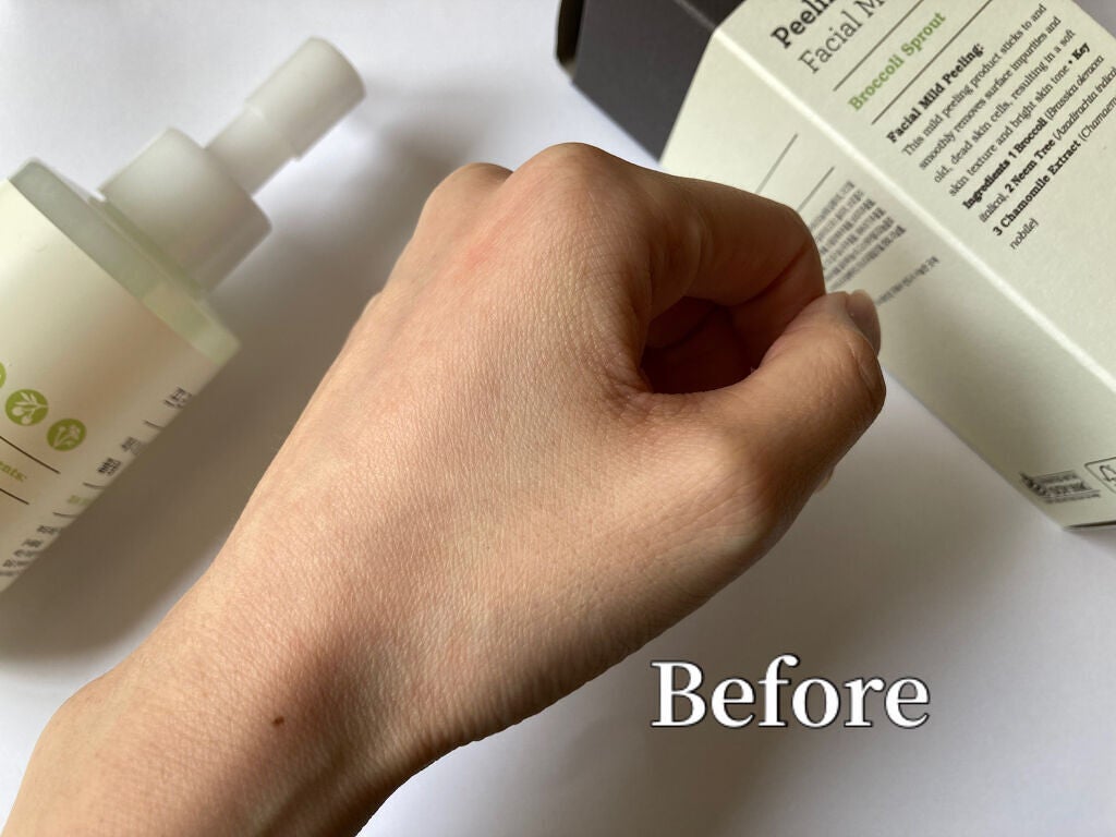 フェイシャルマイルドピーリング/primera/ピーリングを使ったクチコミ(5枚目)