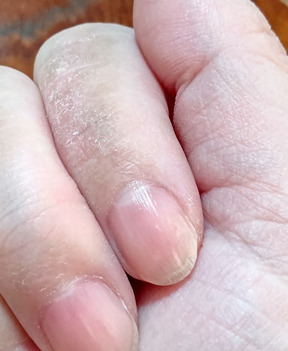 ケアフルネット包帯 指用/ピップ/その他を使ったクチコミ（1枚目）