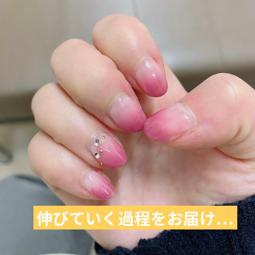 さ on LIPS 「深爪・チビ爪矯正日記🤞私自身ずっと爪を噛むクセがあって大学入っ..」(3枚目)