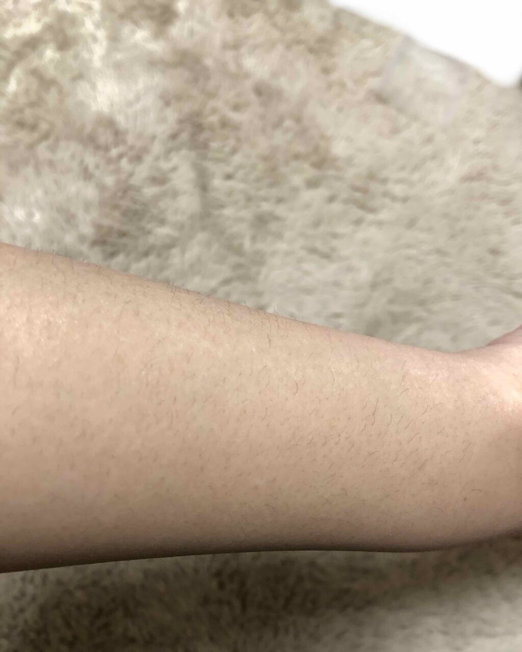 脱毛テープ/エピラット/除毛クリームを使ったクチコミ（2枚目）