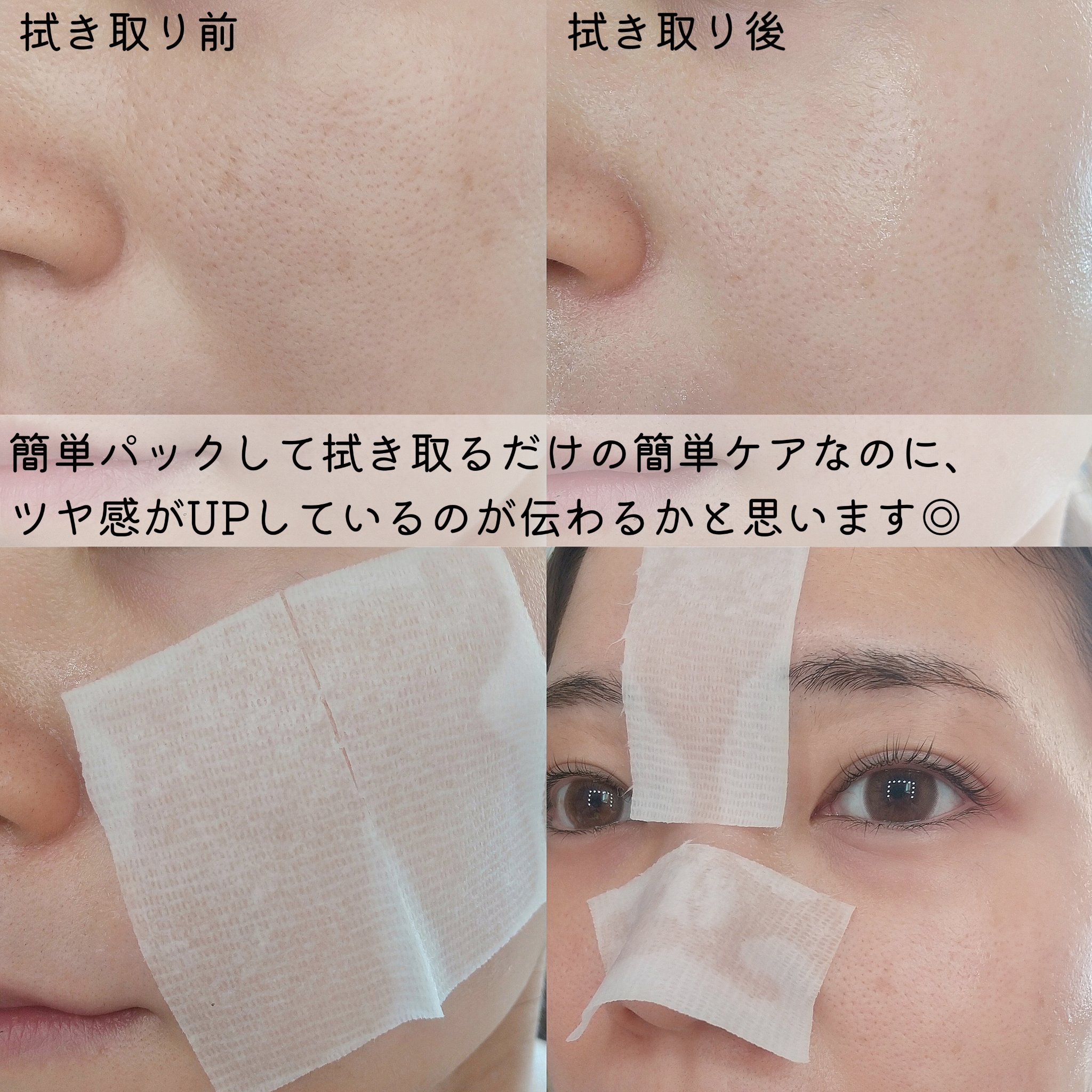 シカピーリングトナーパッド/ONE THING/トナーパッドを使ったクチコミ（3枚目）