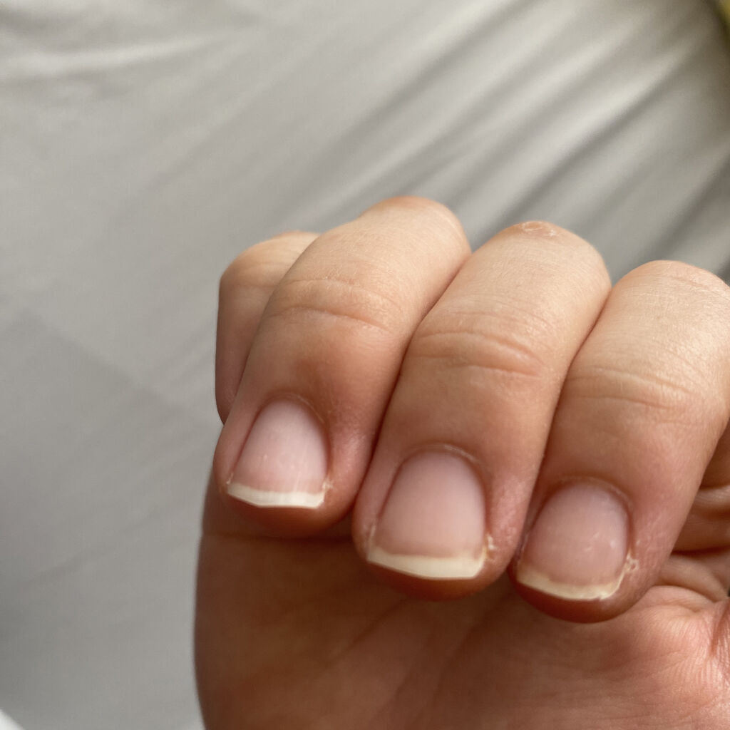 キューティクルオイル/ネイルホリック/ネイルオイル・トリートメントを使ったクチコミ（2枚目）