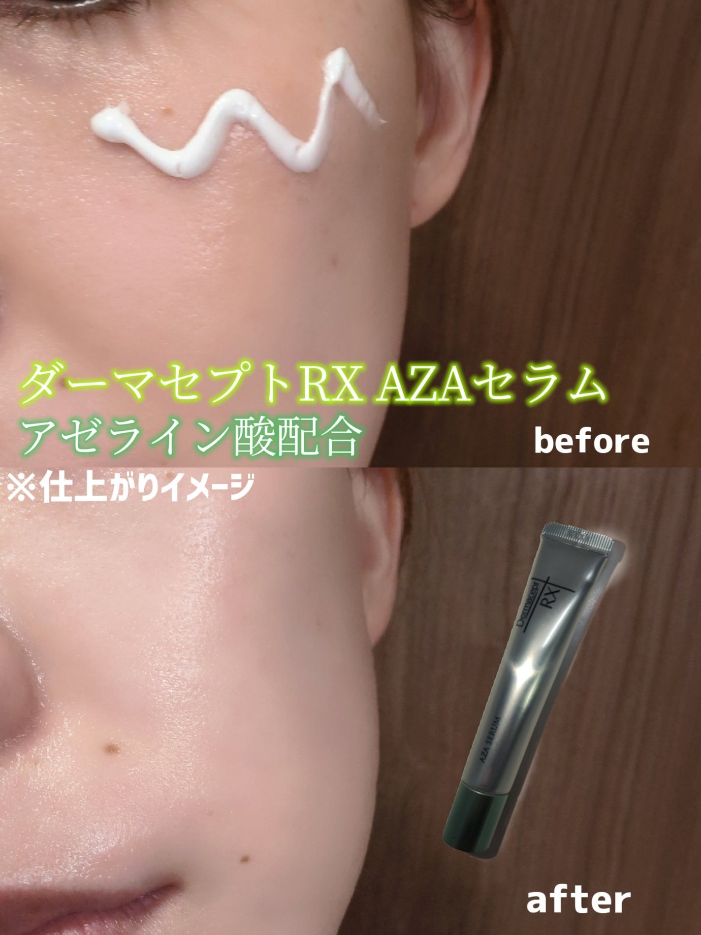 ダーマセプトRX AZAセラム/ダーマセプトRX/美容液を使ったクチコミ(2枚目)