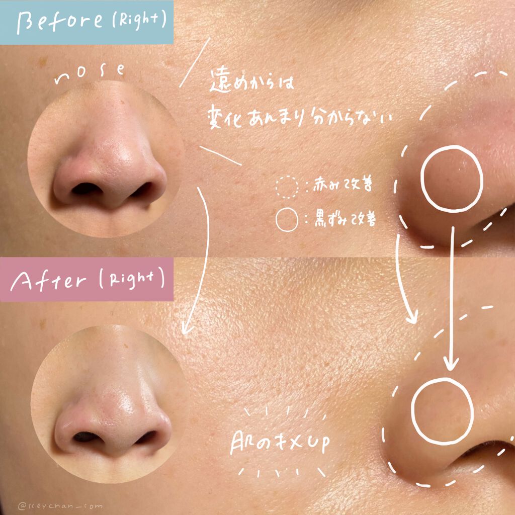 エンリッチCセラム/IGA LAB/美容液を使ったクチコミ(4枚目)