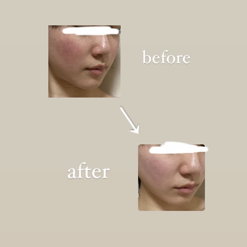 トーンアップ スキン デザイナー/Visée/化粧下地を使ったクチコミ（3枚目）