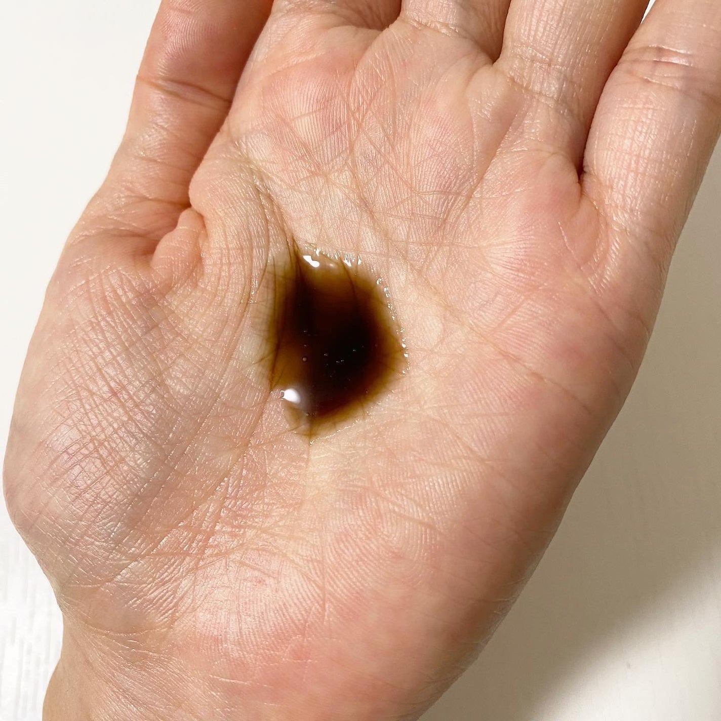 プロヘマチン原液 ヒト幹細胞培養エキス+/fracora/洗い流すヘアトリートメントを使ったクチコミ(3枚目)