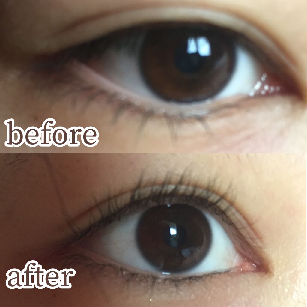 ひとえ・奥ぶたえ用カーラー/アイプチ®/ビューラーを使ったクチコミ（3枚目）