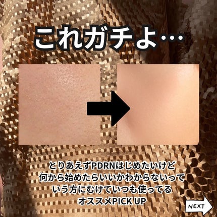 Haru on LIPS 「—————————VTPDRNマスクPDRNアンプル—————..」(4枚目)