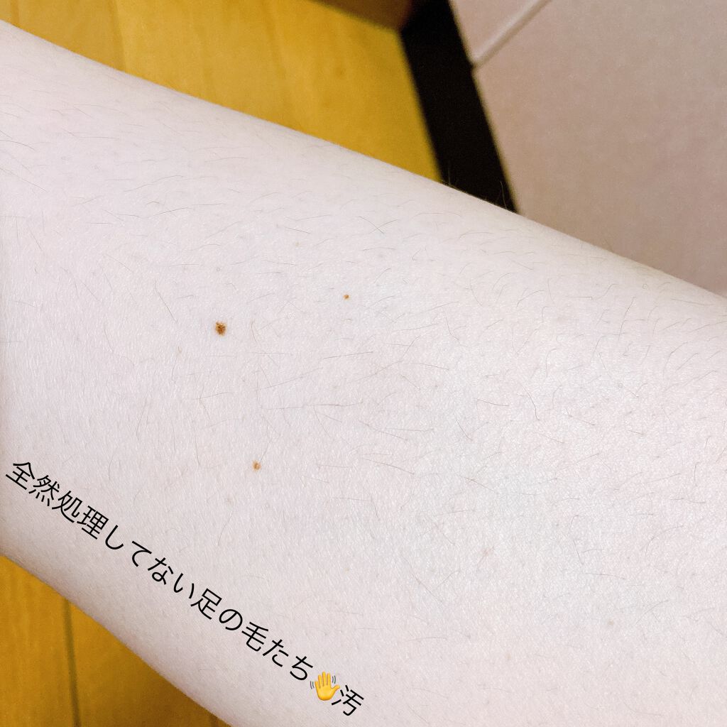 NONON/NONON(ノンノン)/除毛クリームを使ったクチコミ(5枚目)