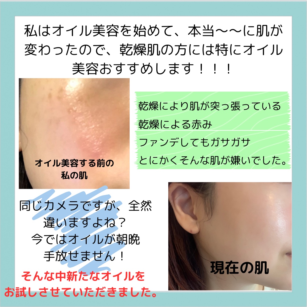 エミィバオバブ美容オイル/emiii/フェイスオイルを使ったクチコミ（2枚目）