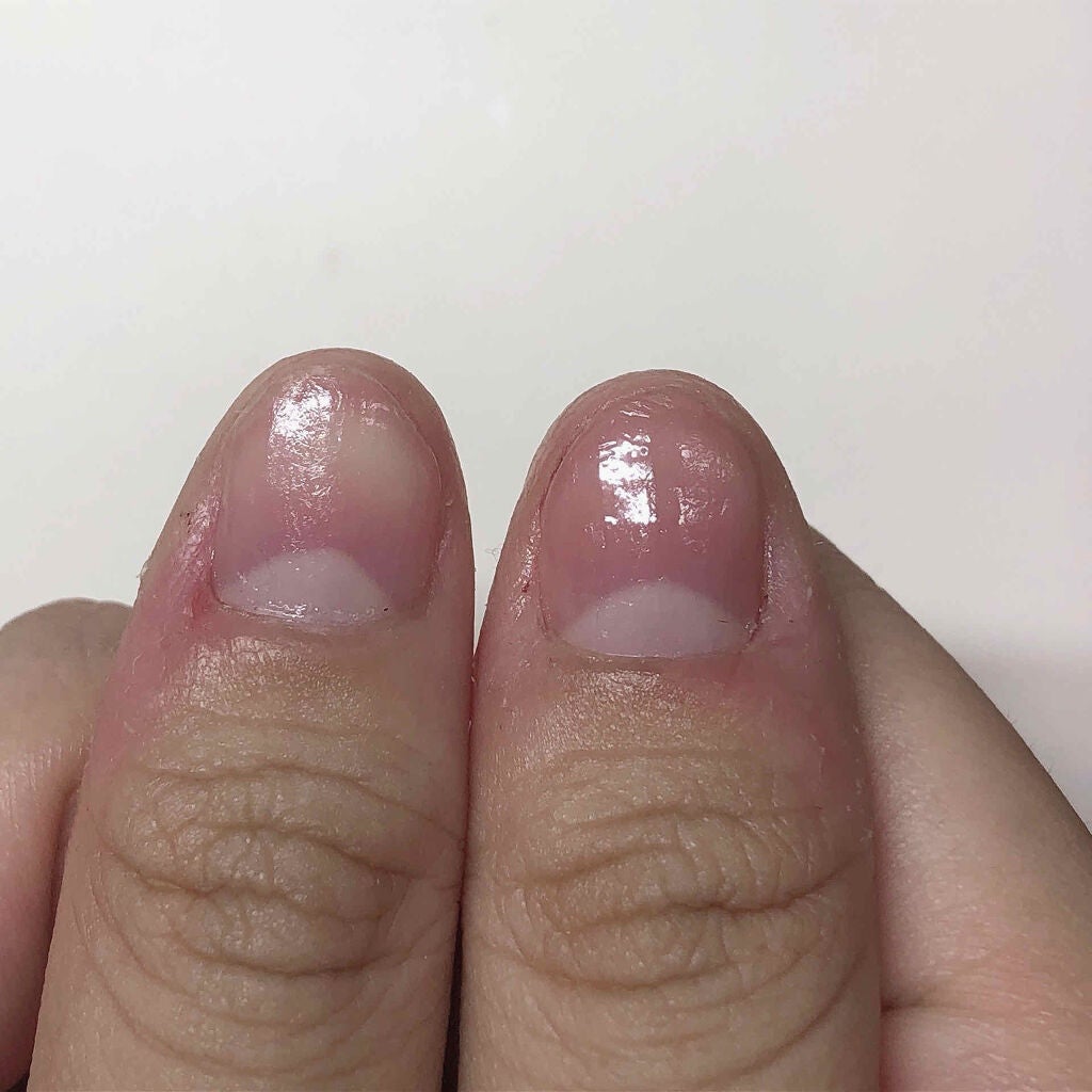 ネイルサポート Na/ネイルネイル/ネイルトップコートを使ったクチコミ(3枚目)