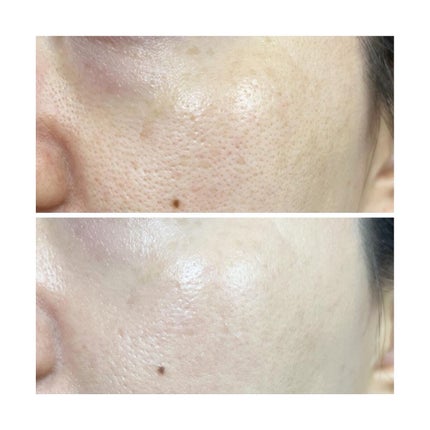 モイストラボ BBエッセンスクリーム/Moist Labo/BBクリームを使ったクチコミ(4枚目)