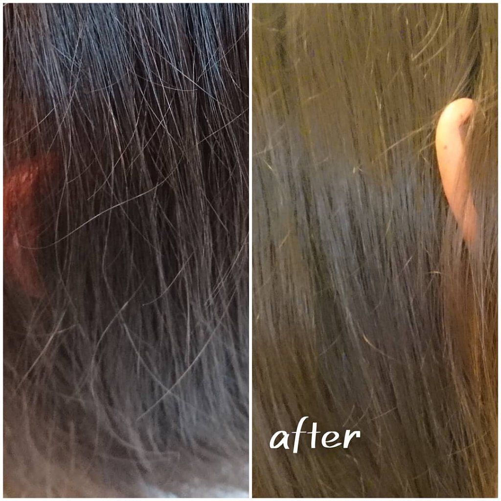 ヘッドスパセブン トリートメント/ヘッドスパセブン/頭皮トリートメントを使ったクチコミ(3枚目)