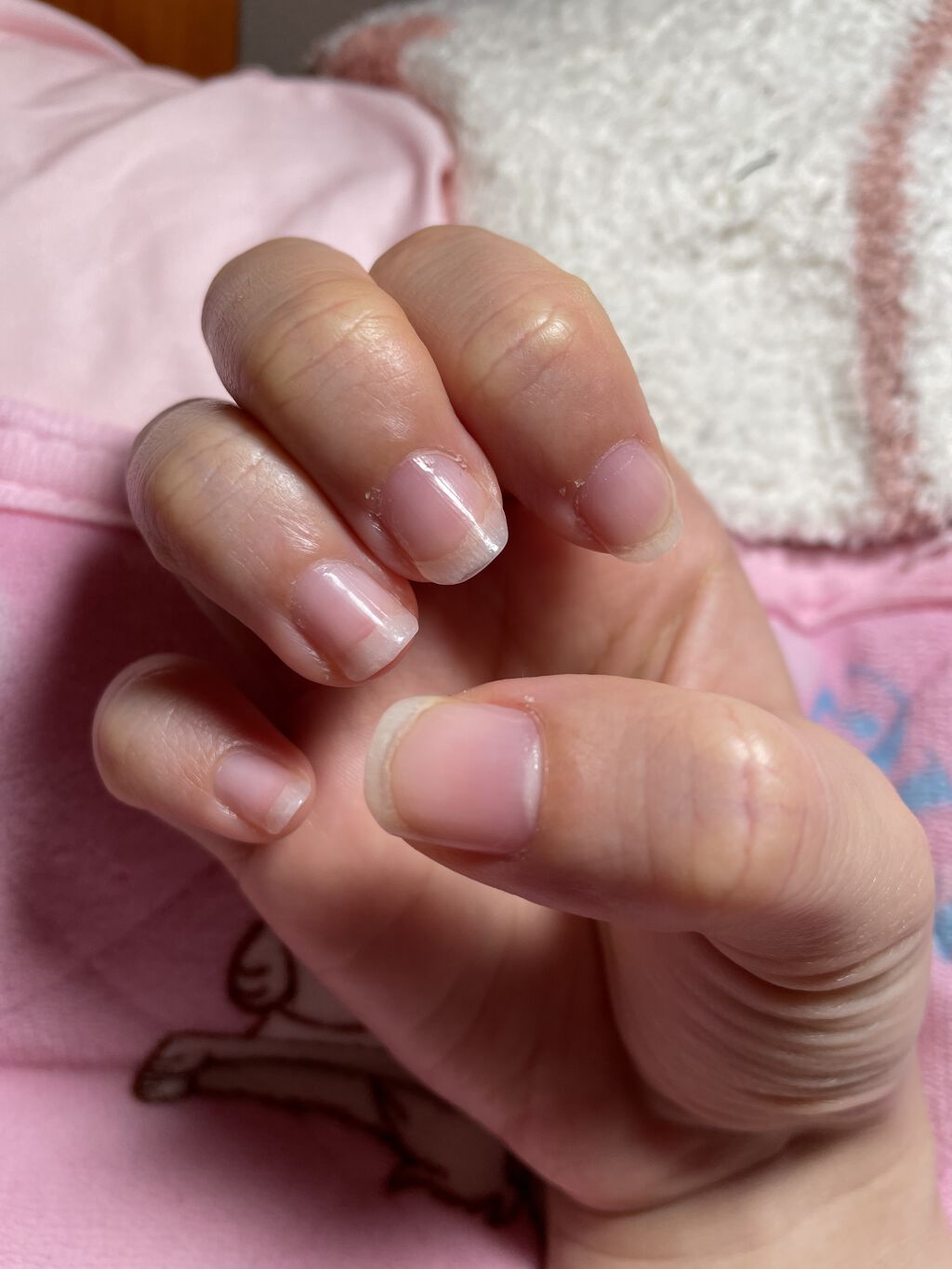 メディケイティッド エクストラクリーム/アトリックス/ハンドクリームを使ったクチコミ（1枚目）