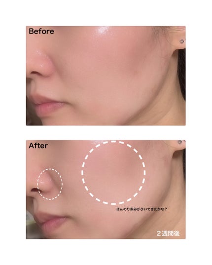 パンテショット675/COSNORI/美容液を使ったクチコミ(5枚目)