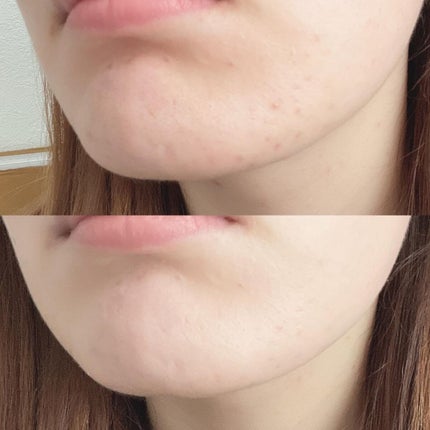 カーミンググロウアップクッションファンデーション/favs/リキッドファンデーションを使ったクチコミ(4枚目)